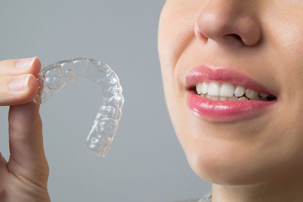 Holding clear retainer — Buffalo Grove, IL — Rosen Orthodontics