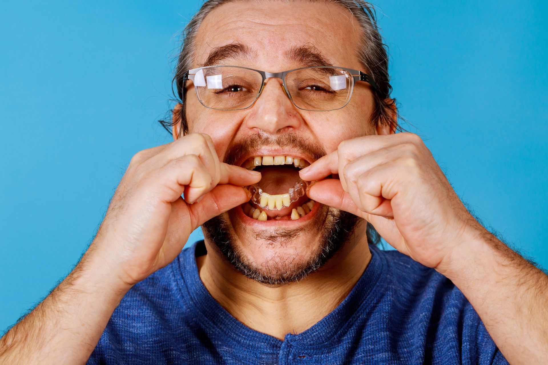 A man wearing glasses is holding his teeth in his mouth.