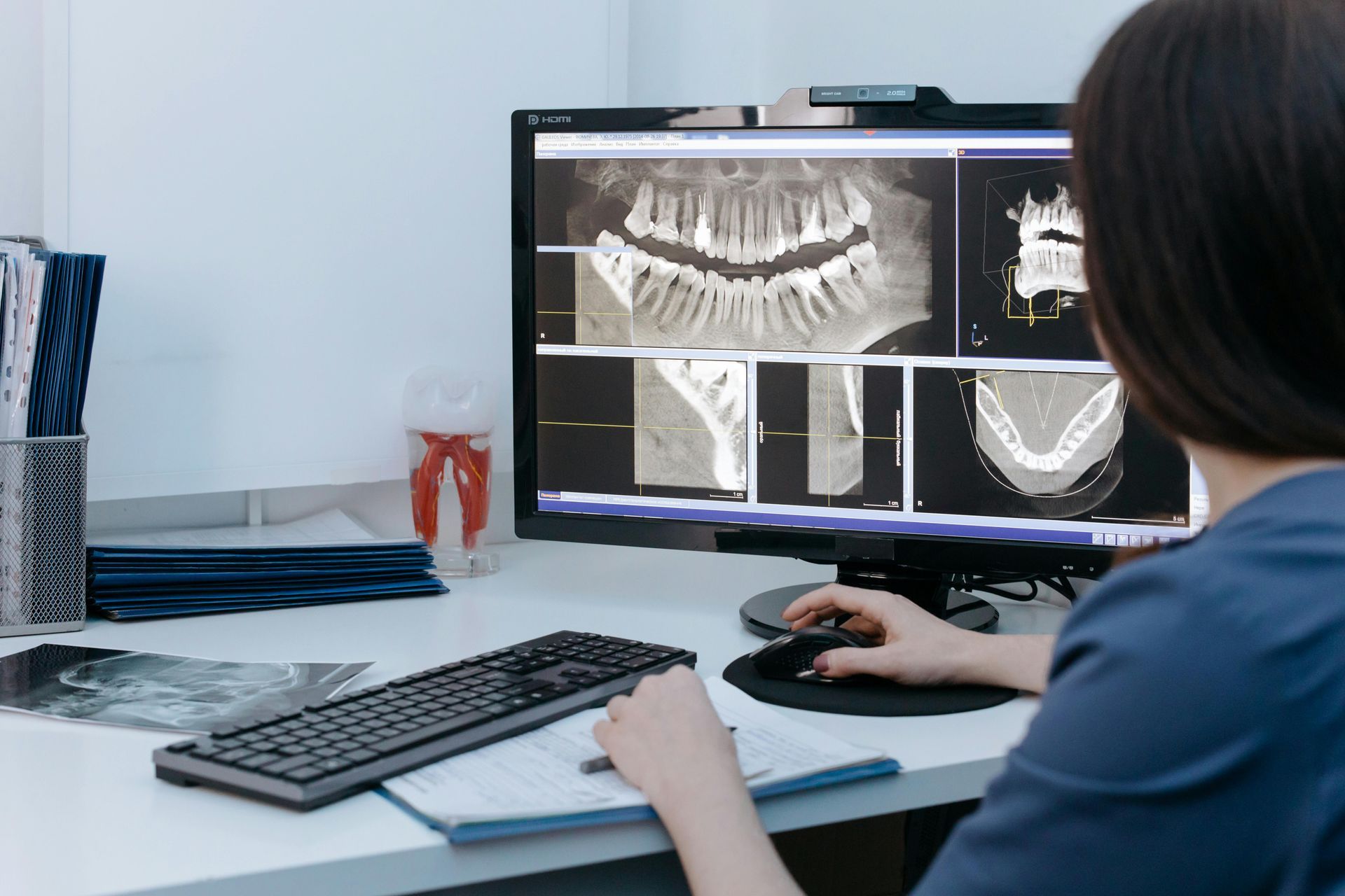 A woman is sitting at a desk looking at an x-ray on a computer screen.