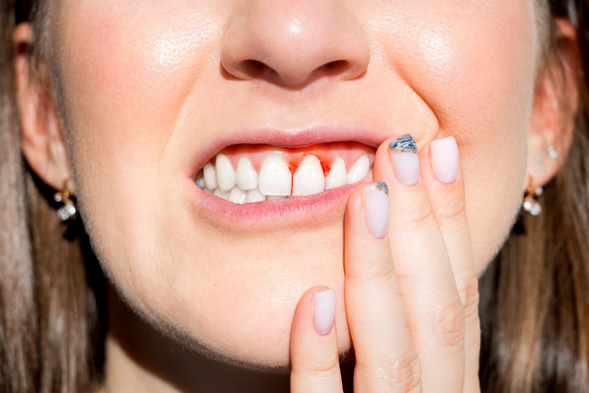 A close up of a woman 's mouth with a toothache.