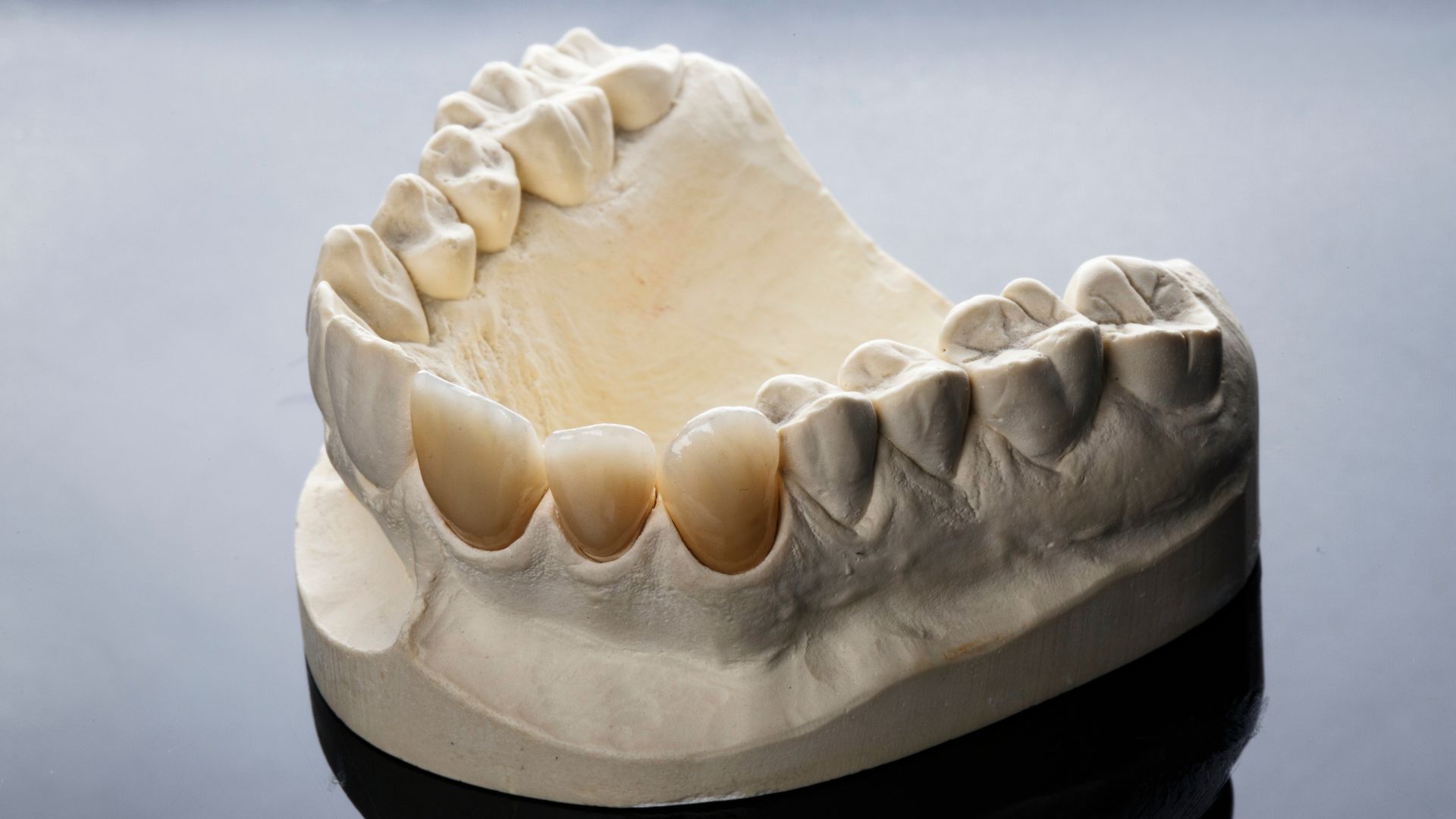A close up of a model of a person 's teeth on a table.