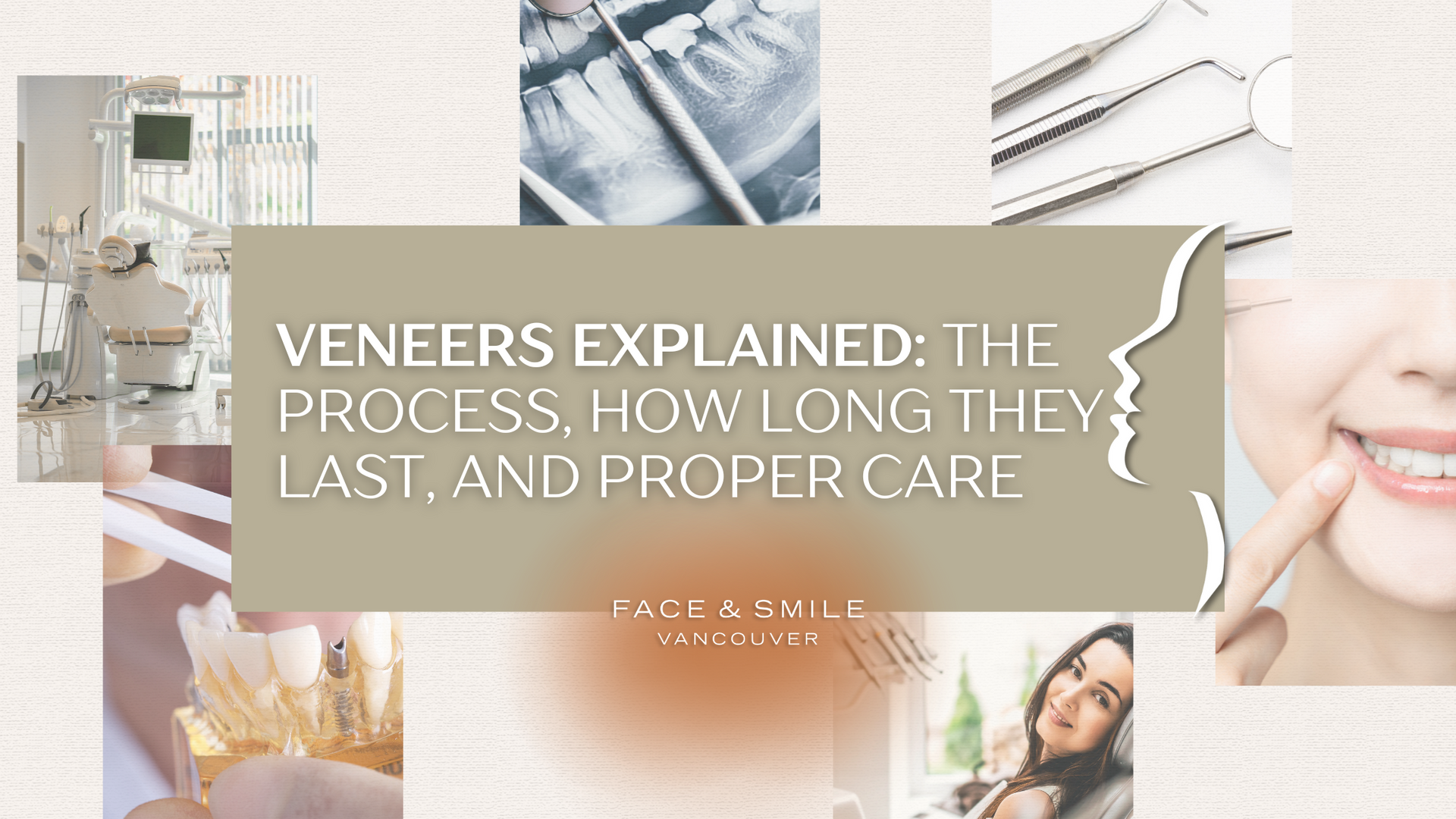 Collage on dental veneers. Text: