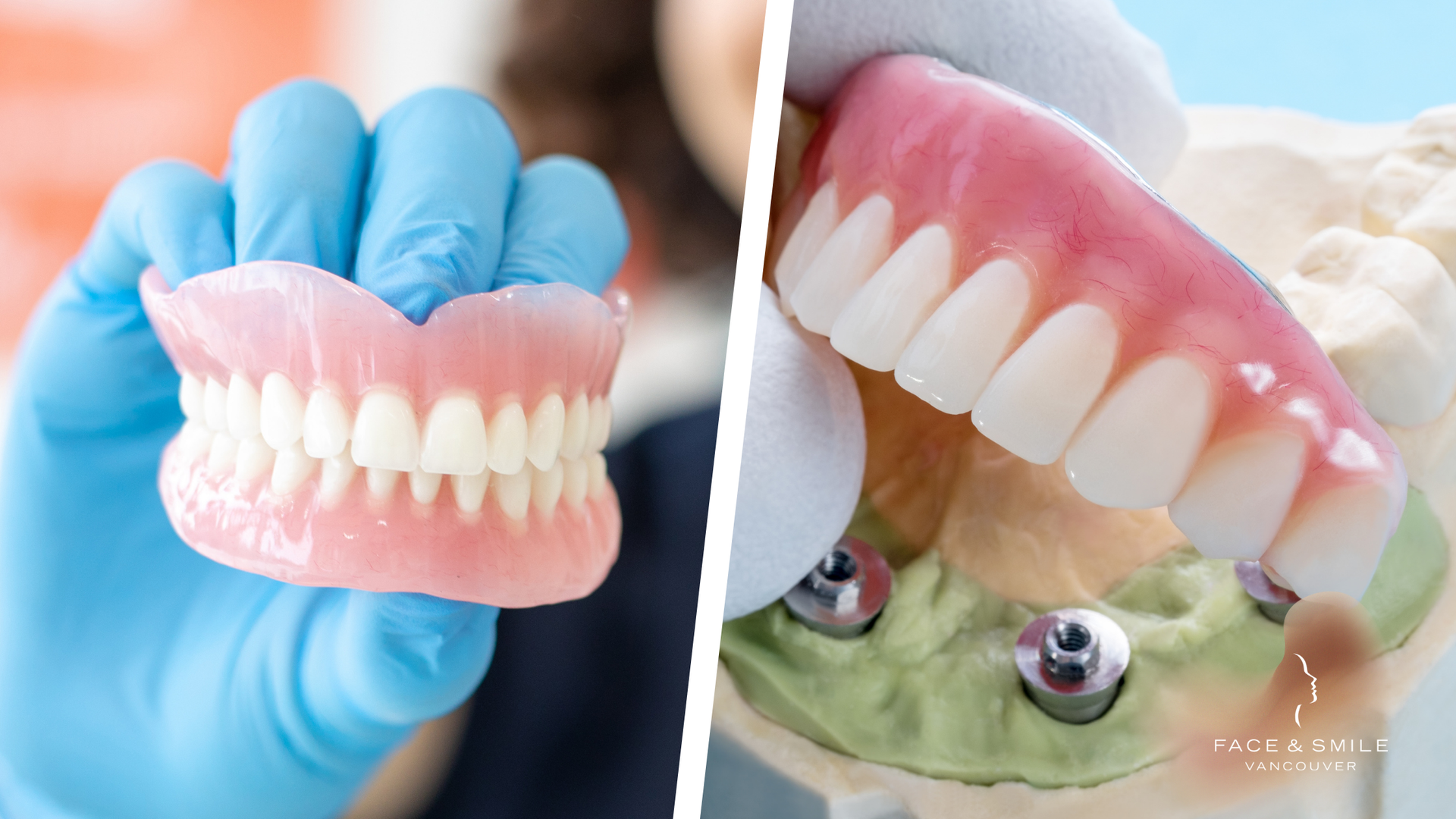 A person is holding a denture next to a model of a denture.