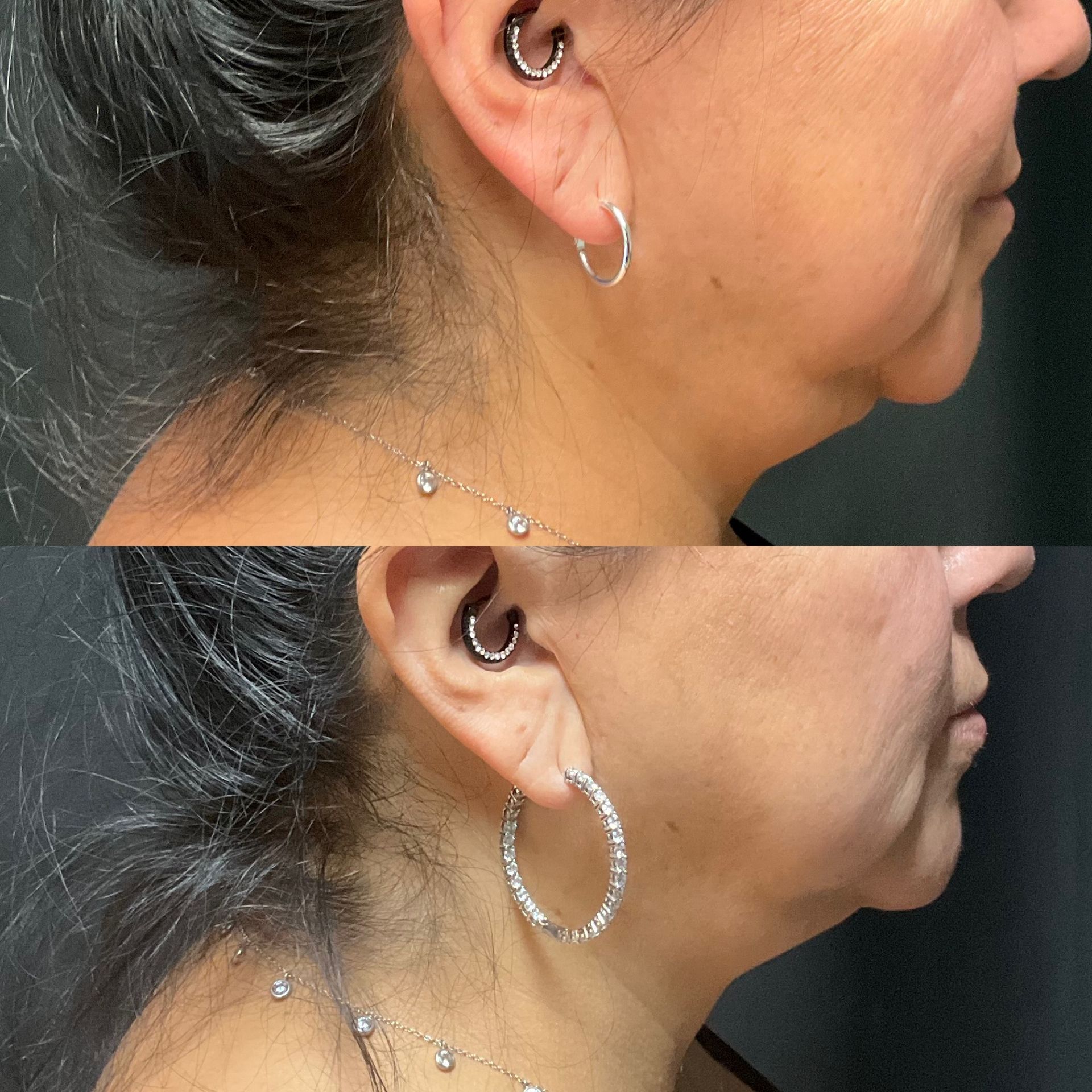 A before and after photo of a woman wearing hoop earrings