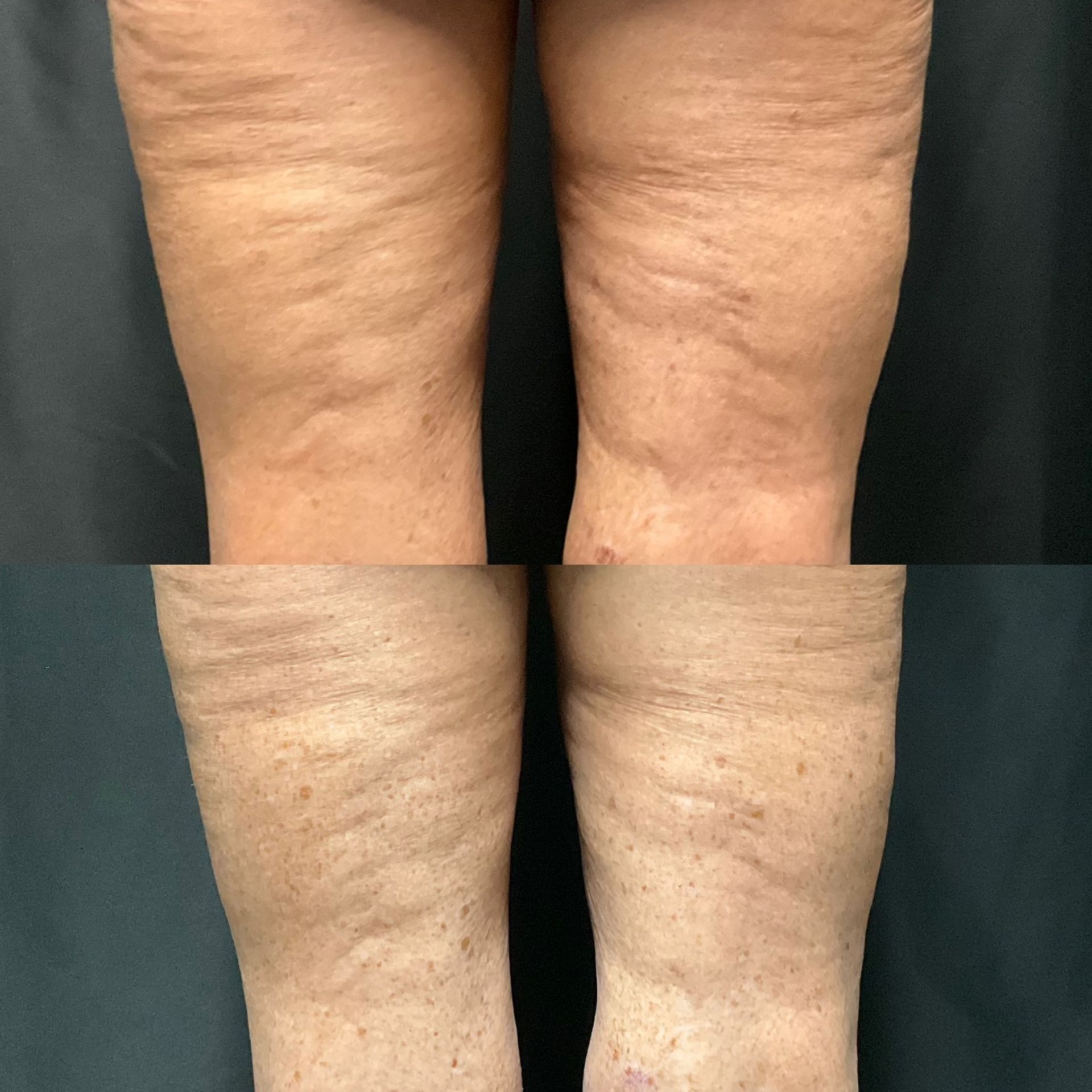 A before and after photo of a person 's legs