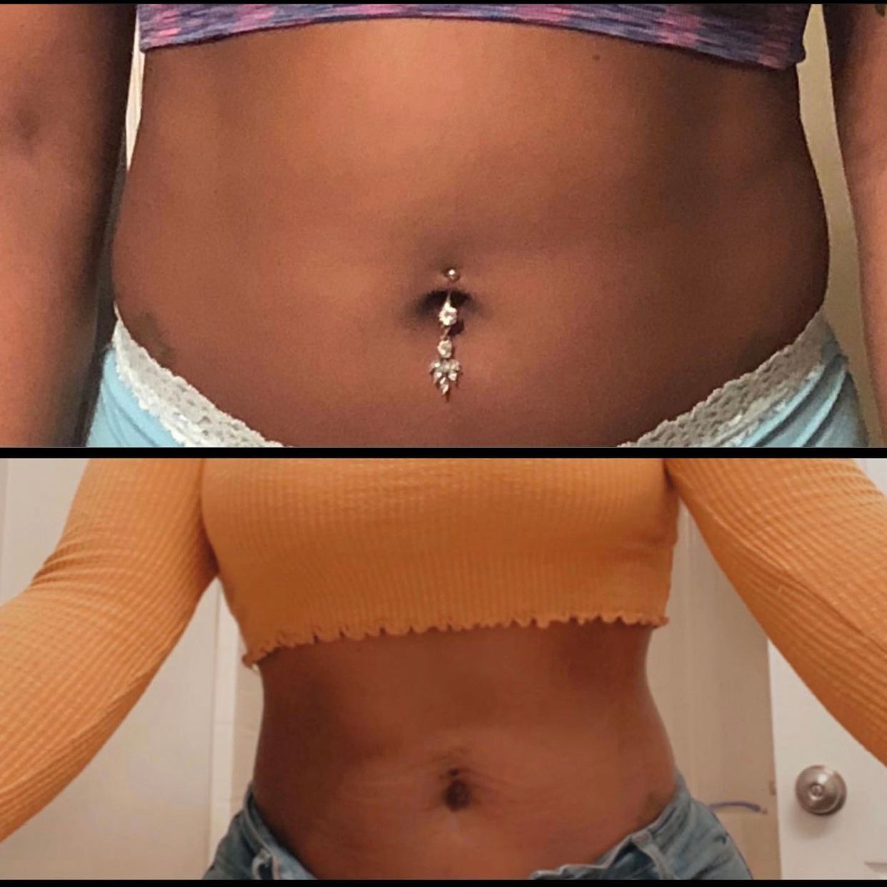 A before and after picture of a woman 's belly