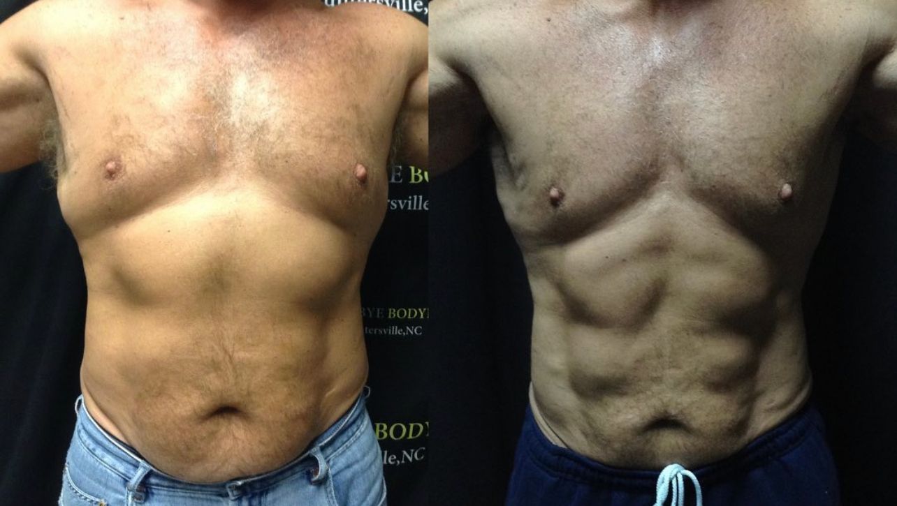 Treatment Before and After