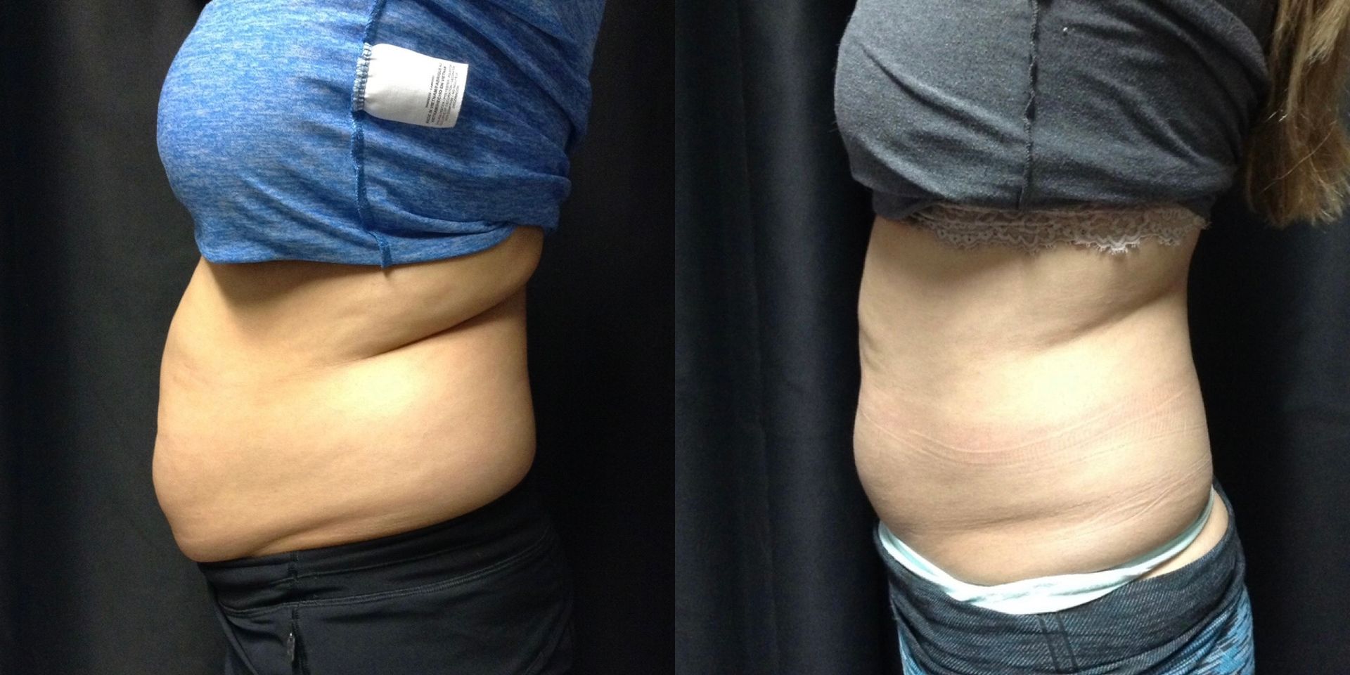 Treatment Before and After