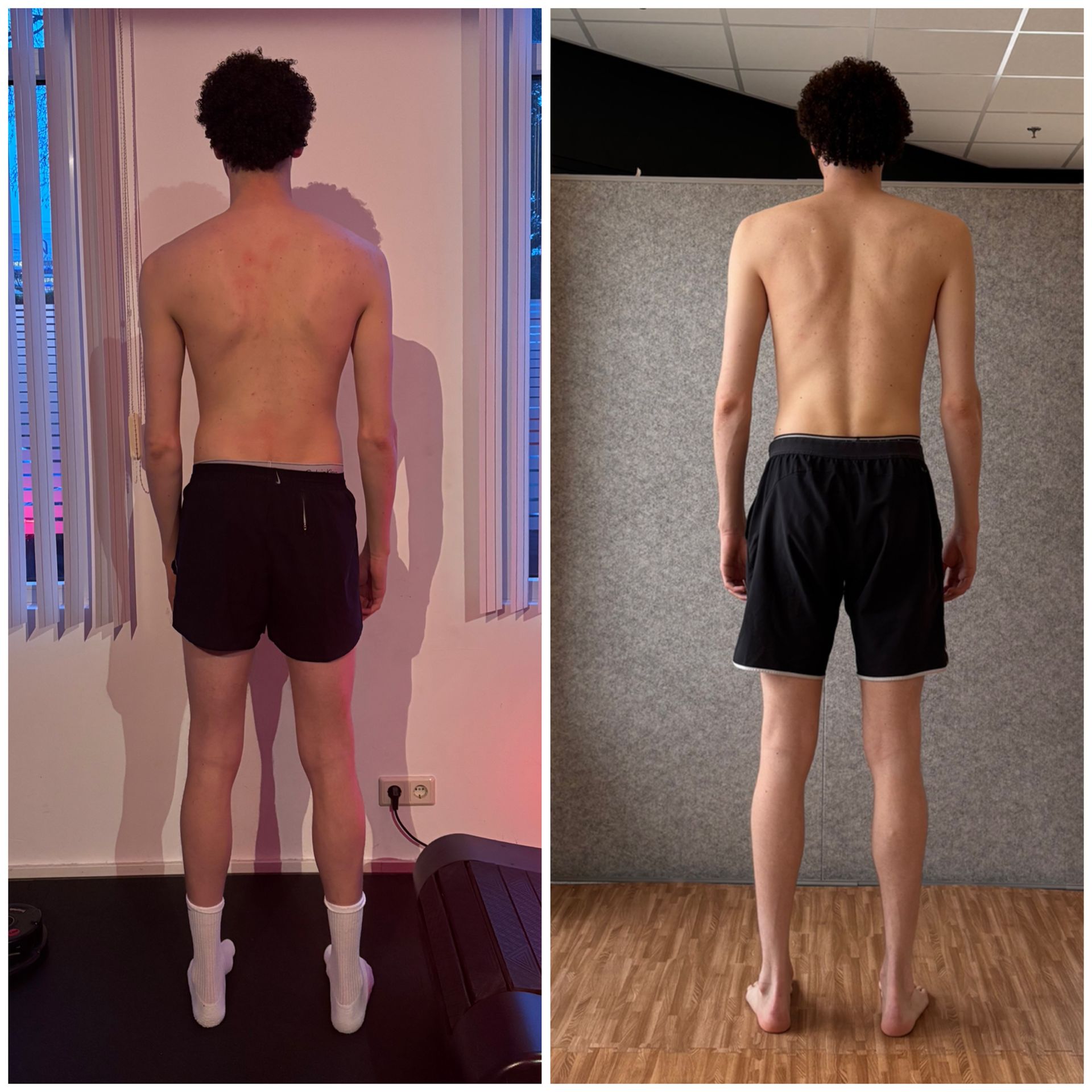 From Cronic Pain to Peak Perfornamce