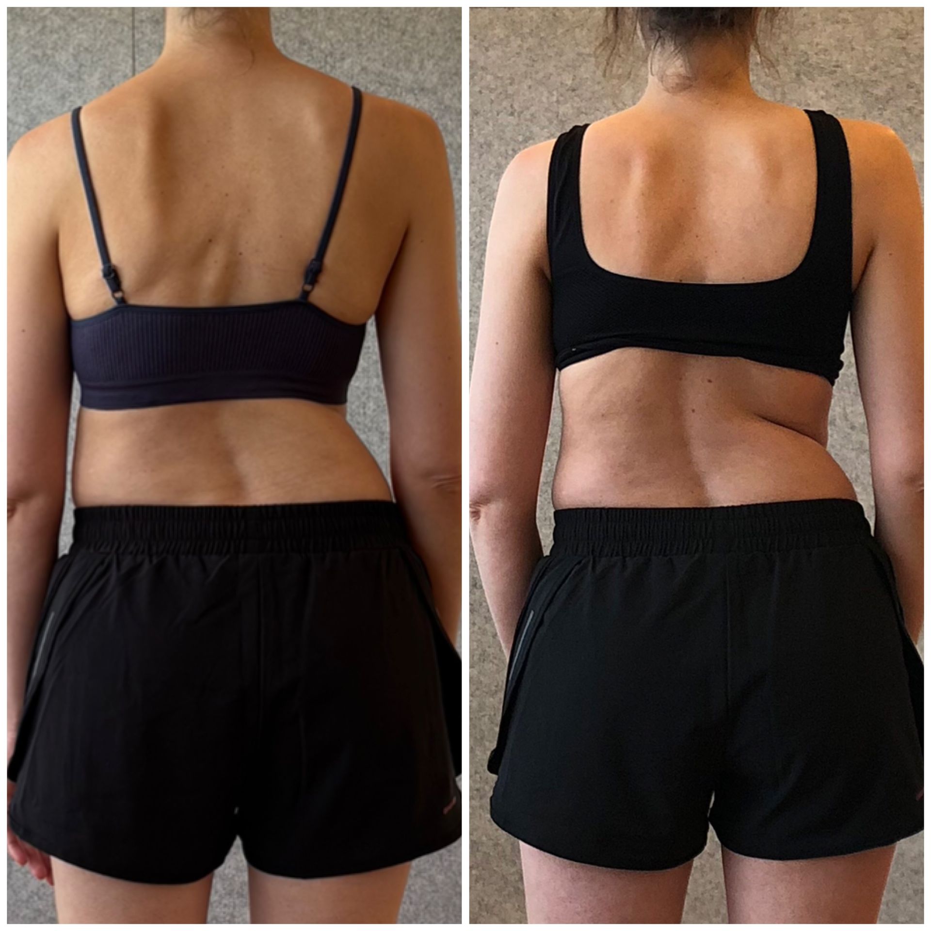 Scoliosis reduction and pain relief