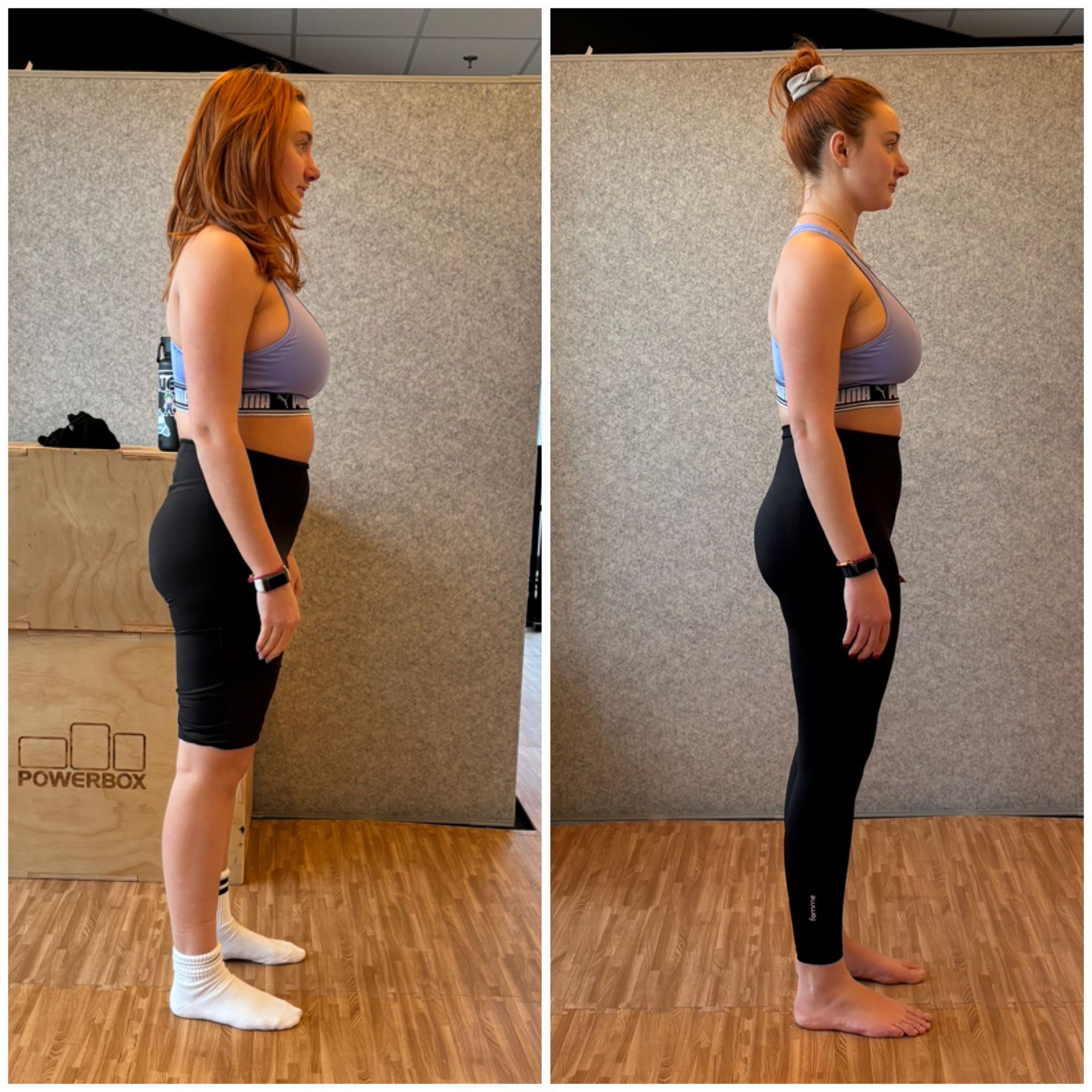 From Sciatica to pain-free living