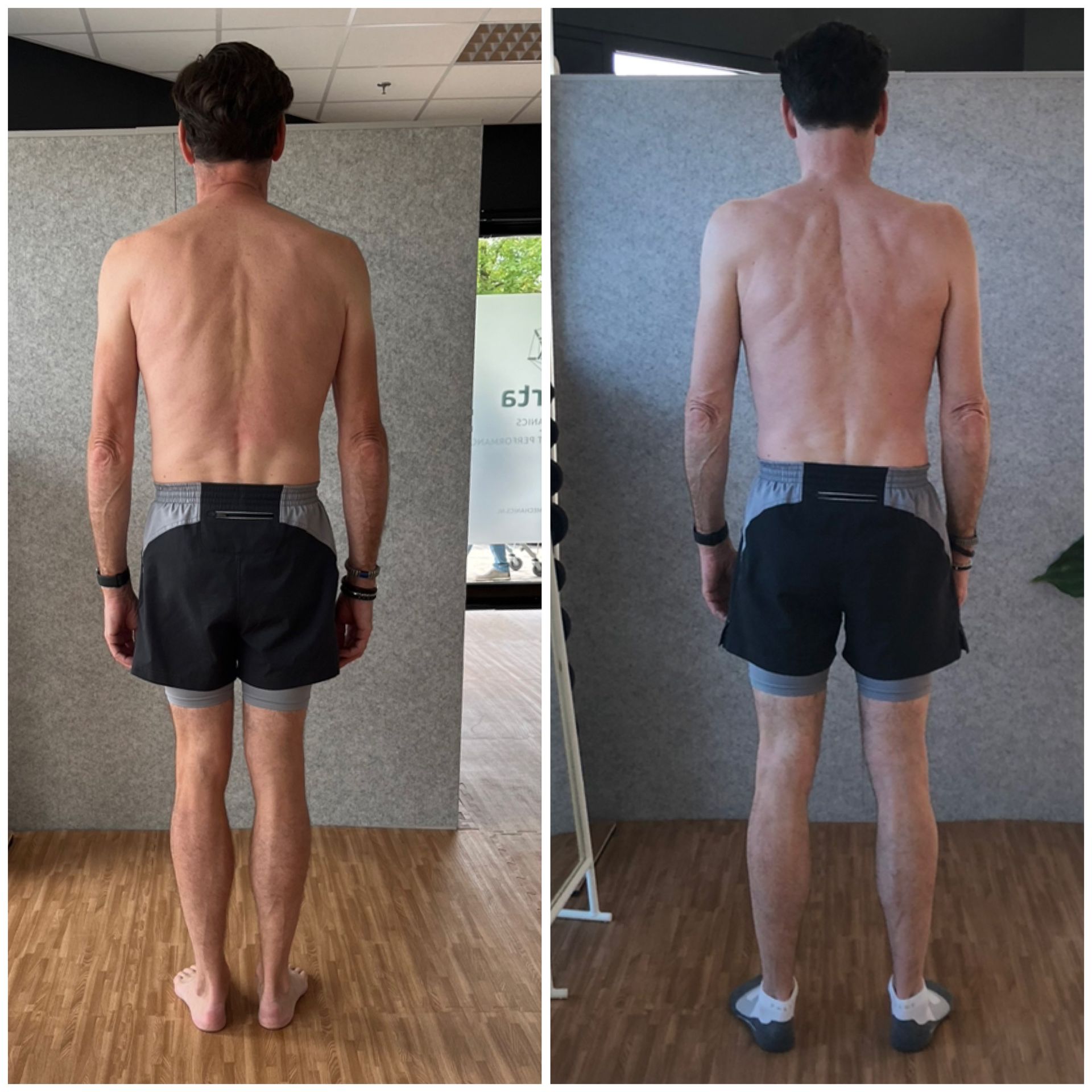 Hamstring and back pain gone after years