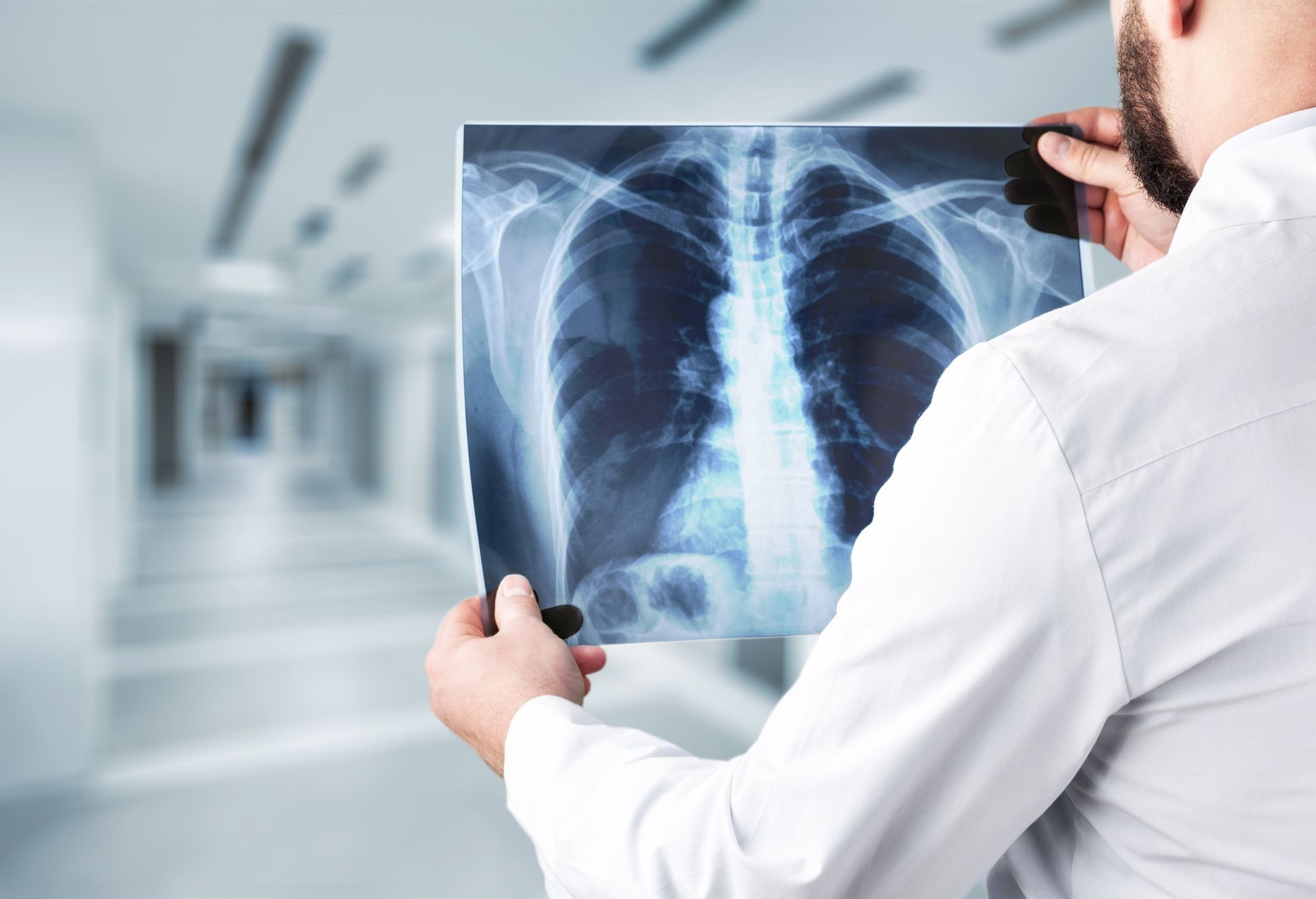 picture of doctor on the hallway turned back while showing an x-ray film of someone's chest.