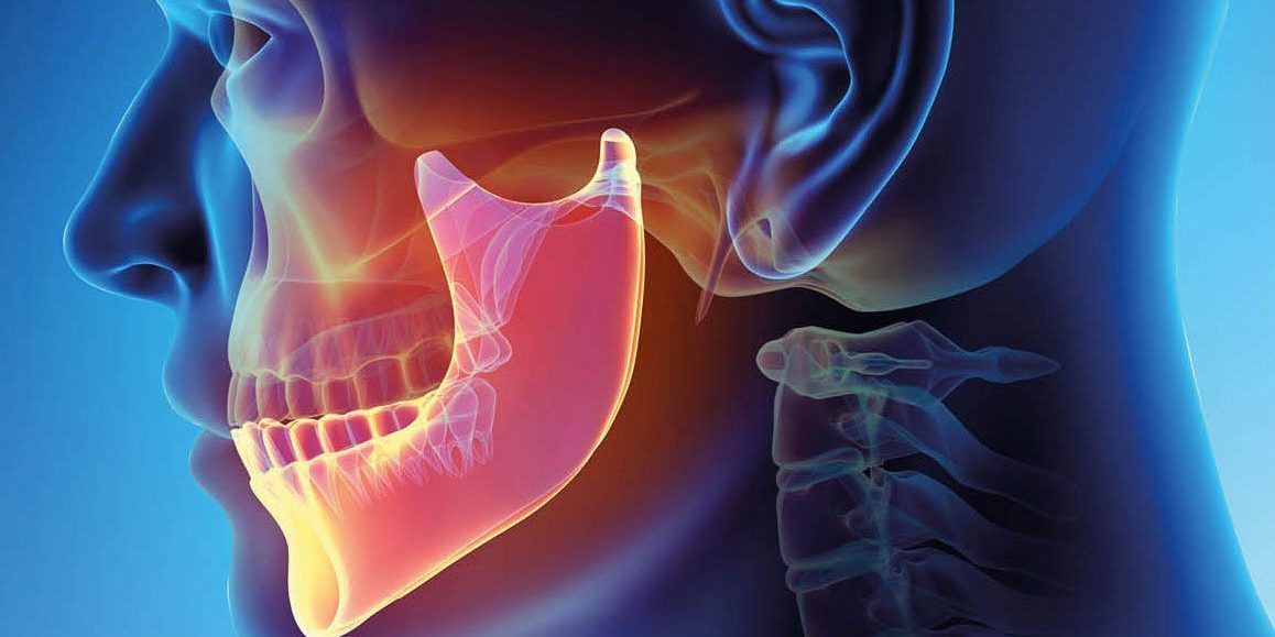 apparecchio ai denti