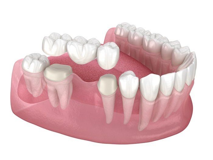 dentista illustra intervento