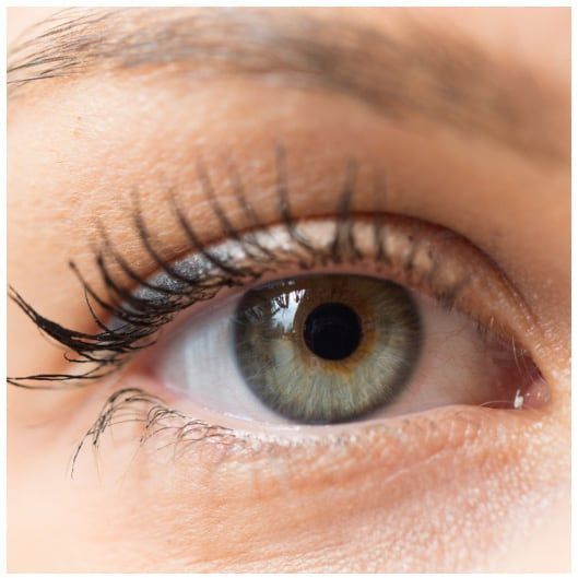 After Dry Eye Treatment