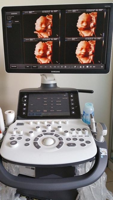 HD ultrasound scans