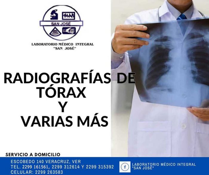 LABORATORIO MÉDICO SAN JOSÉ - radiofrafía de tórax