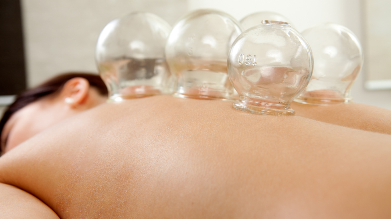 A person is getting a cupping massage on their back.