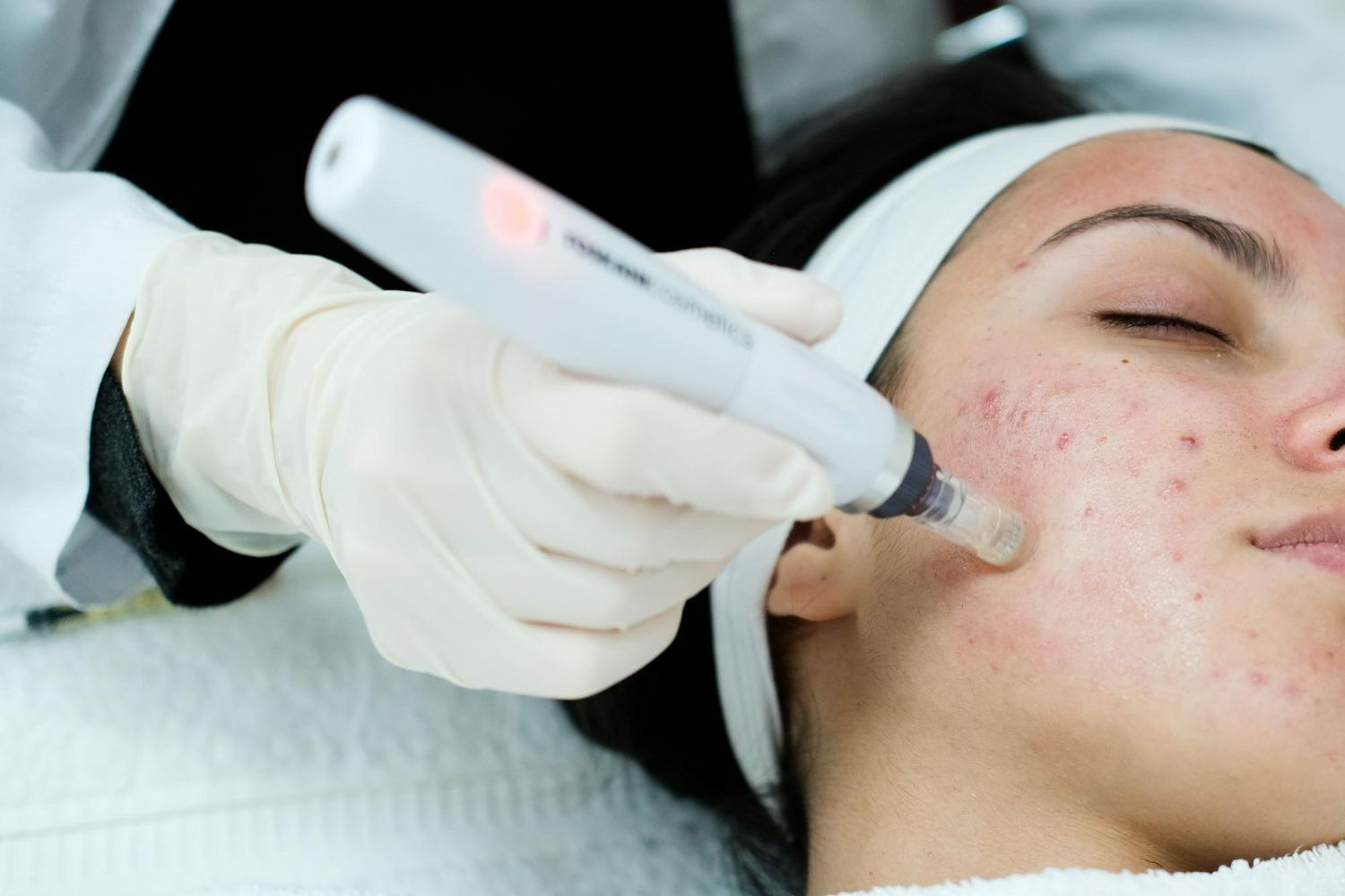 A woman is getting a treatment on her face