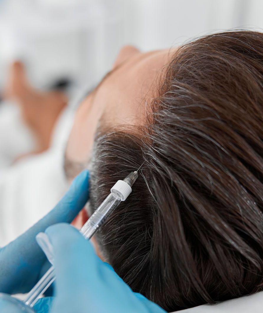man getting injections in scalp