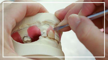 Making Dentures — denture repairs in Fredericksburg, VA