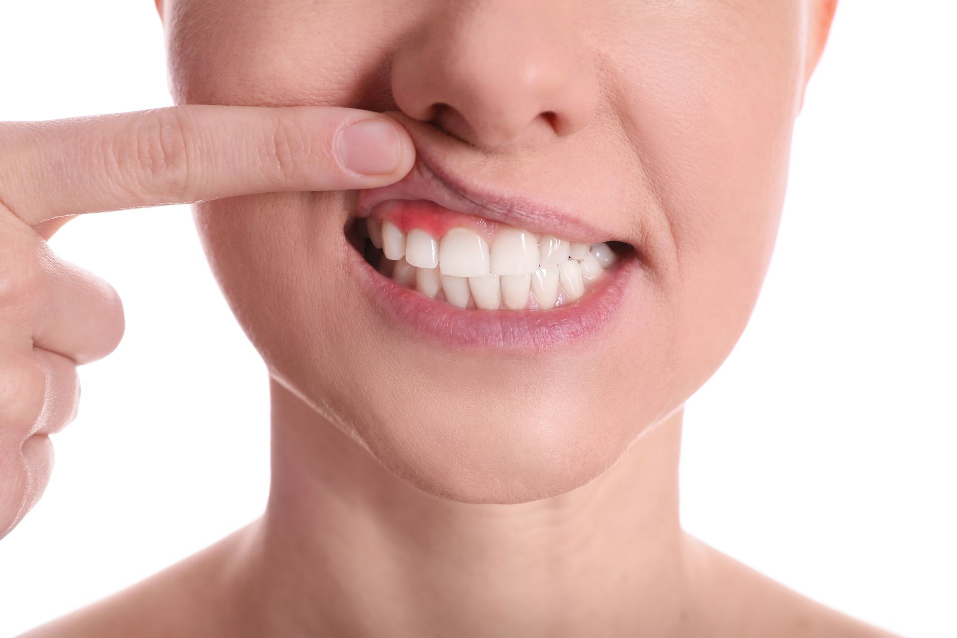 A woman is pointing at her teeth with her finger.