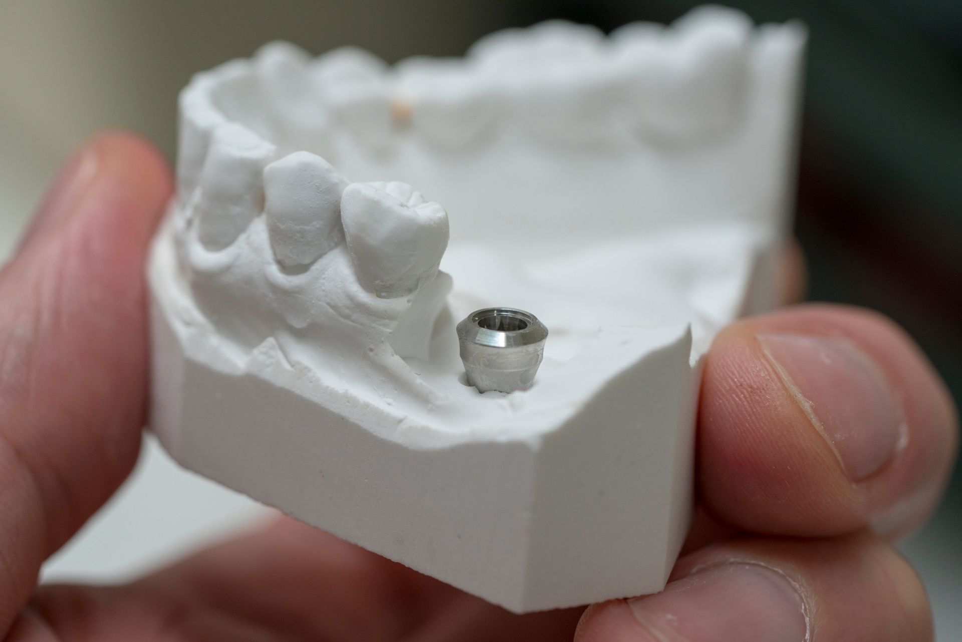 A person is holding a model of a tooth with a dental implant.