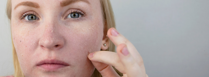 A woman is looking at her dry face in the mirror.