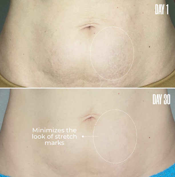 MAELYS RE-LURE Tight & Tone Body Serum