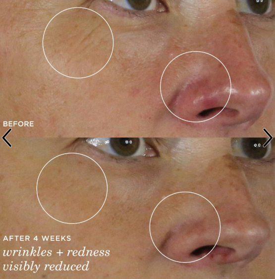 Tatcha The Silk Serum Wrinkle-Smoothing Retinol Alternative