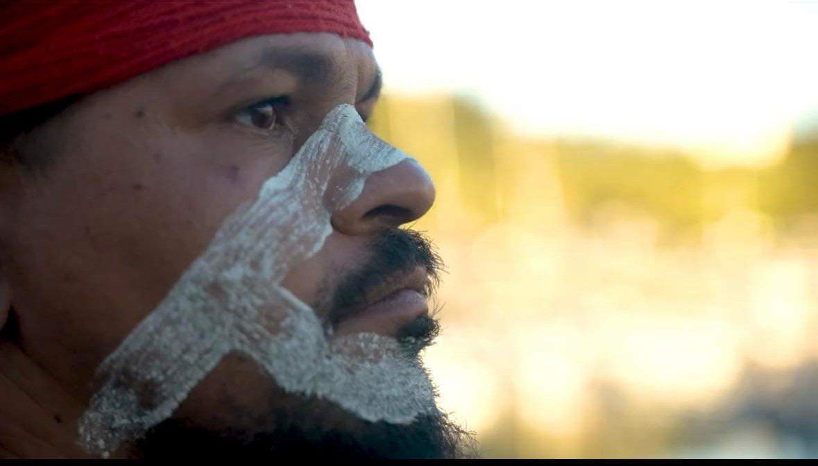 A man with a bandage on his face is wearing a red headband.