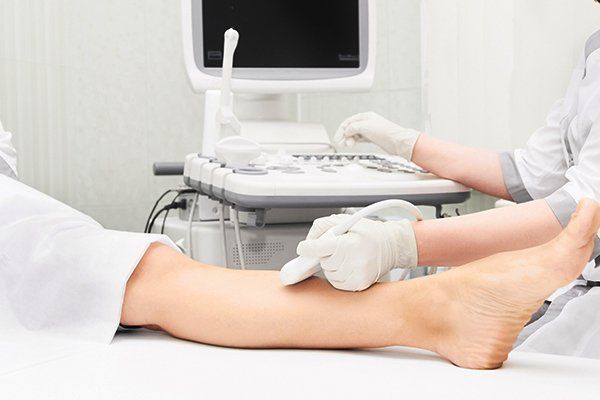 Leg Treatment — Watkinsville, GA — The Vein Clinic At Athens Dermatology Group