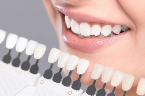 Dentures — Dentures & Dental Implants in Bend, OR