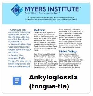 Ankyloglossia