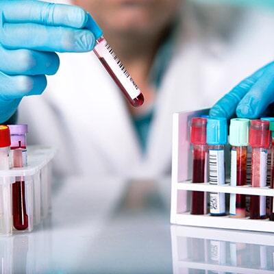 QUÍMICA MÉDICA DE CÓRDOBA - análisis de hormonas y anticuerpos en Córdoba