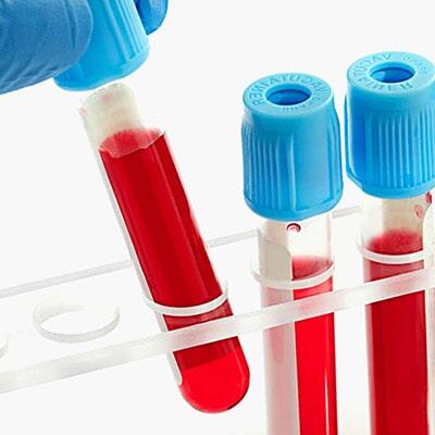 QUÍMICA MÉDICA DE CÓRDOBA - prueba de antígenos en Córdoba