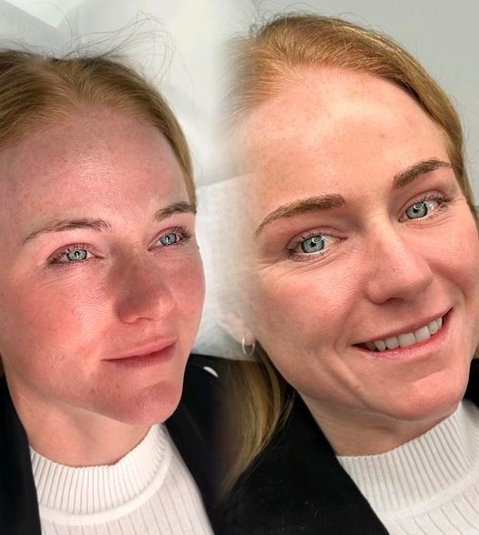 Before and after photos of a woman's face, showing improved makeup. Red hair, blue eyes, smiling.