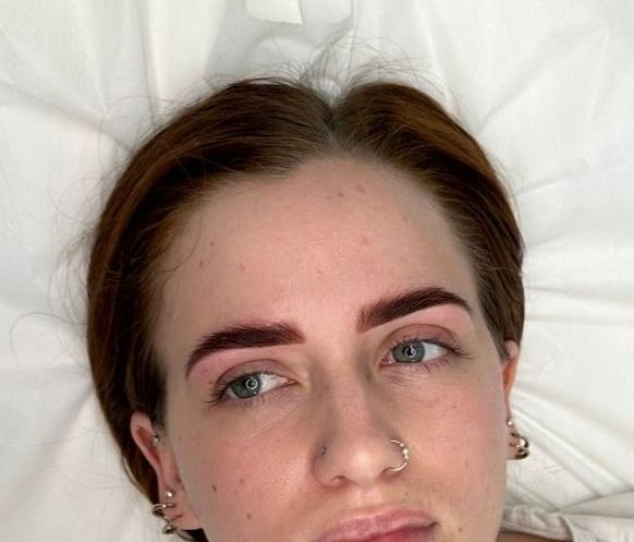 Woman with newly microbladed eyebrows, reddish-brown, resting on white, looks at the camera.