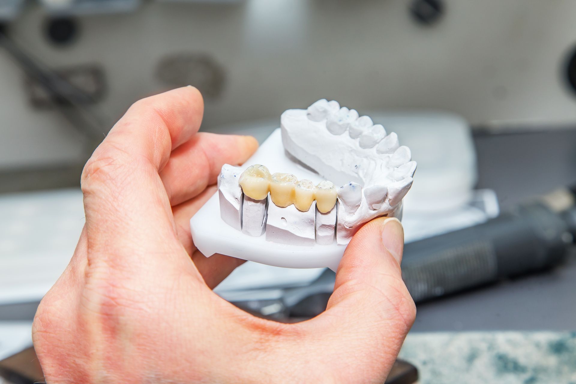 Hand holding a dental model with teeth and braces in a clinic setting Hand holding a dental model with teeth and braces in a clinic setting