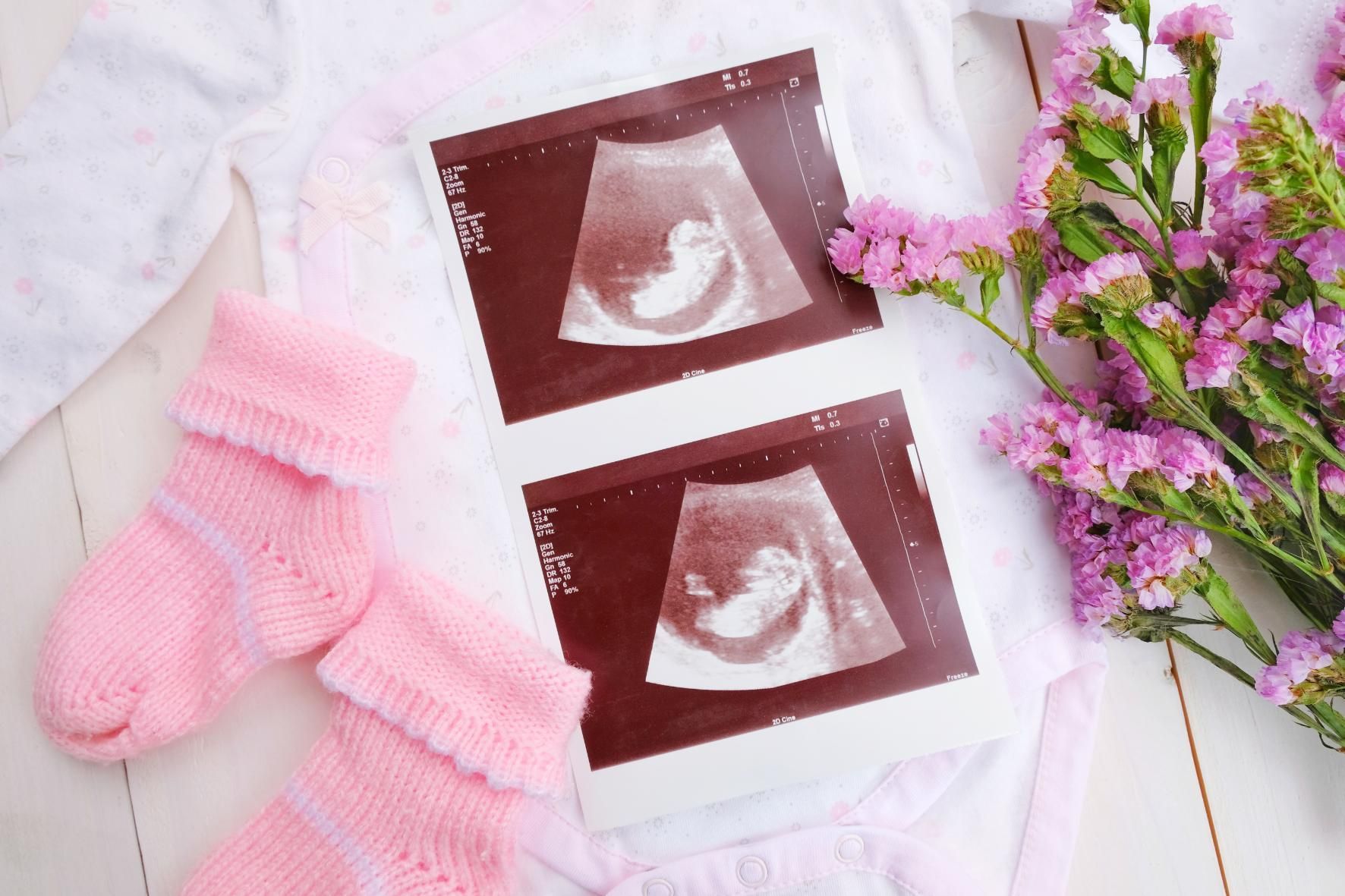 Pink baby socks and ultrasound images on a white onesie next to purple flowers.