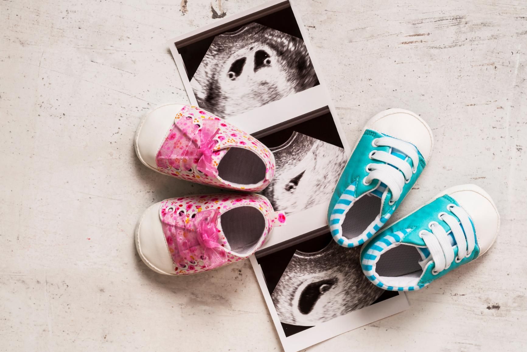 Ultrasound images next to pink and blue baby shoes, on a white surface.