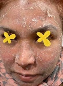 A close up of a woman 's face with yellow flowers on her eyes.