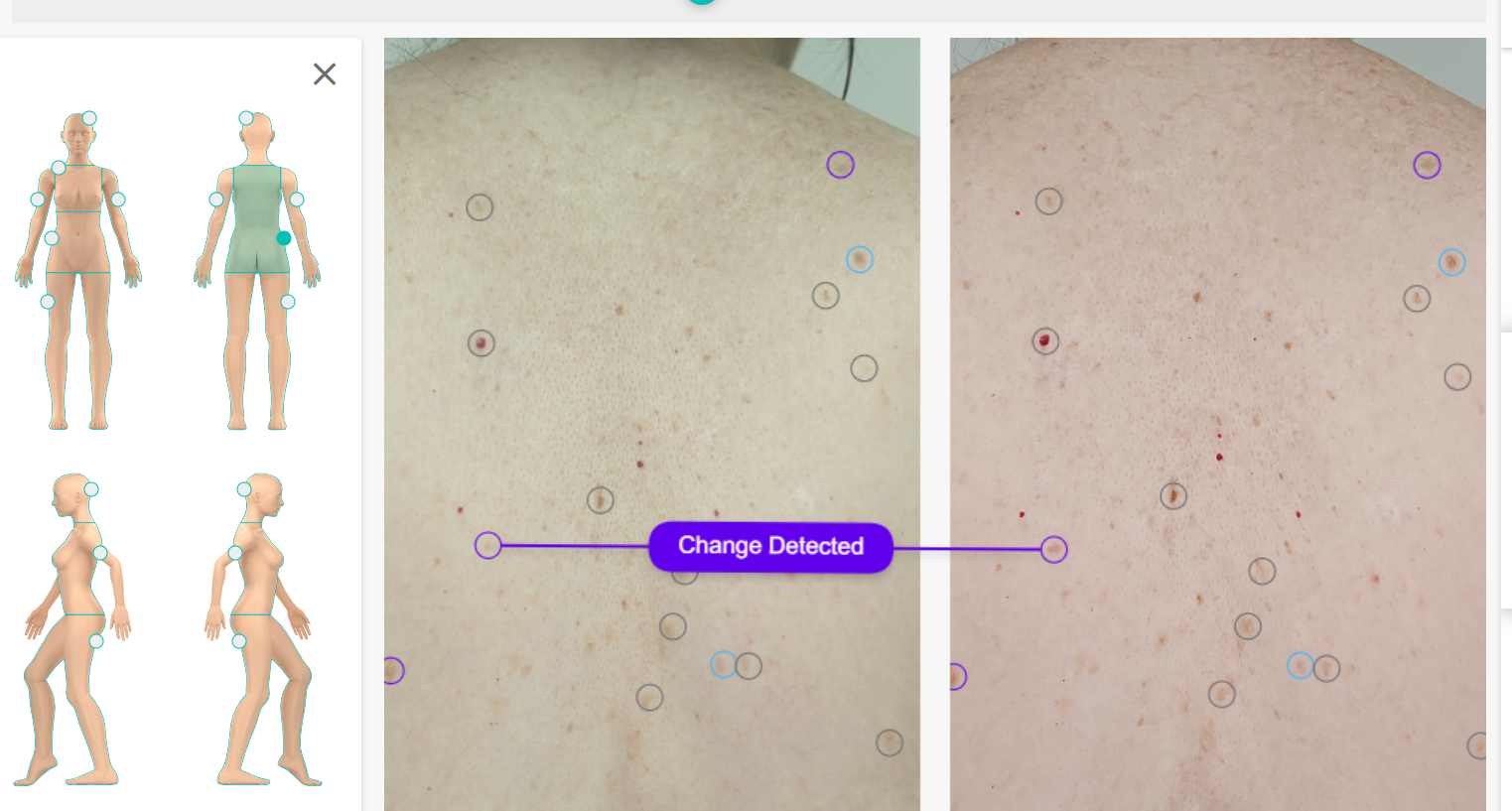 A computer screen shows a picture of a person 's back and a picture of a person 's chest.