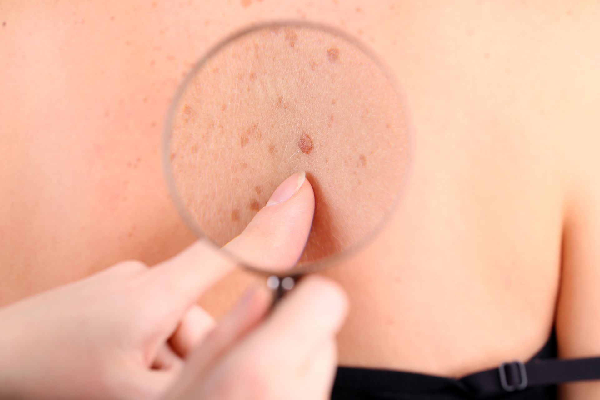 A person is looking at a woman 's back with a magnifying glass.