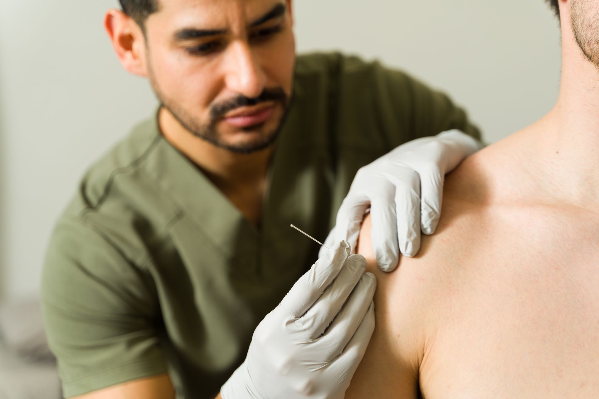 Physiotherapist performing dry needling treatment on male patient's shoulder.