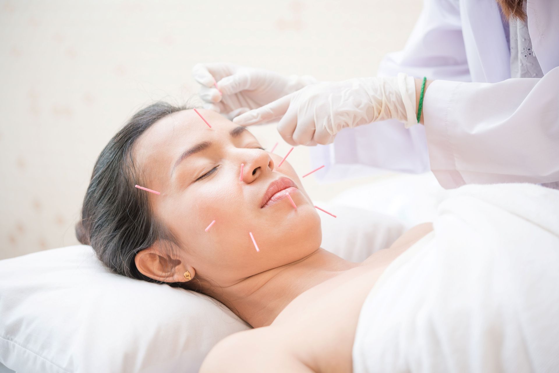A patient receiving facial acupuncture treatment from a specialist at a local acupuncture clinic.