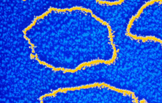 Bright blue background with a yellow outlined circular object; the outline is thick and textured.