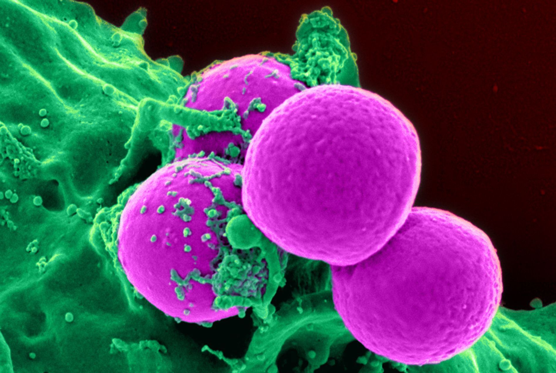 Bright pink spherical bacteria clustered together on a textured green surface.
