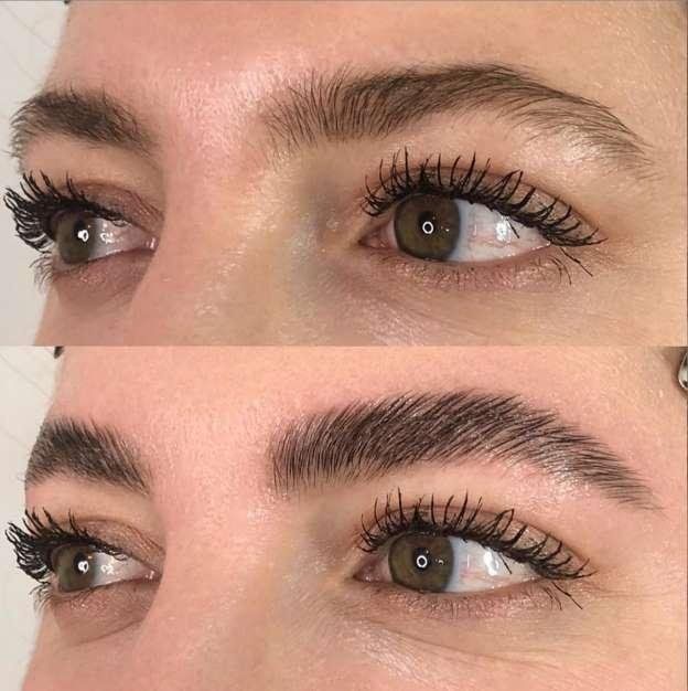 Une photo avant et après des sourcils d'une femme.